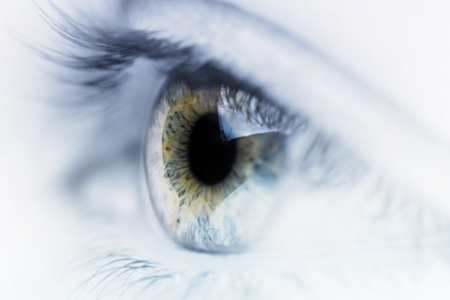 نزدیک بینی (Myopia)